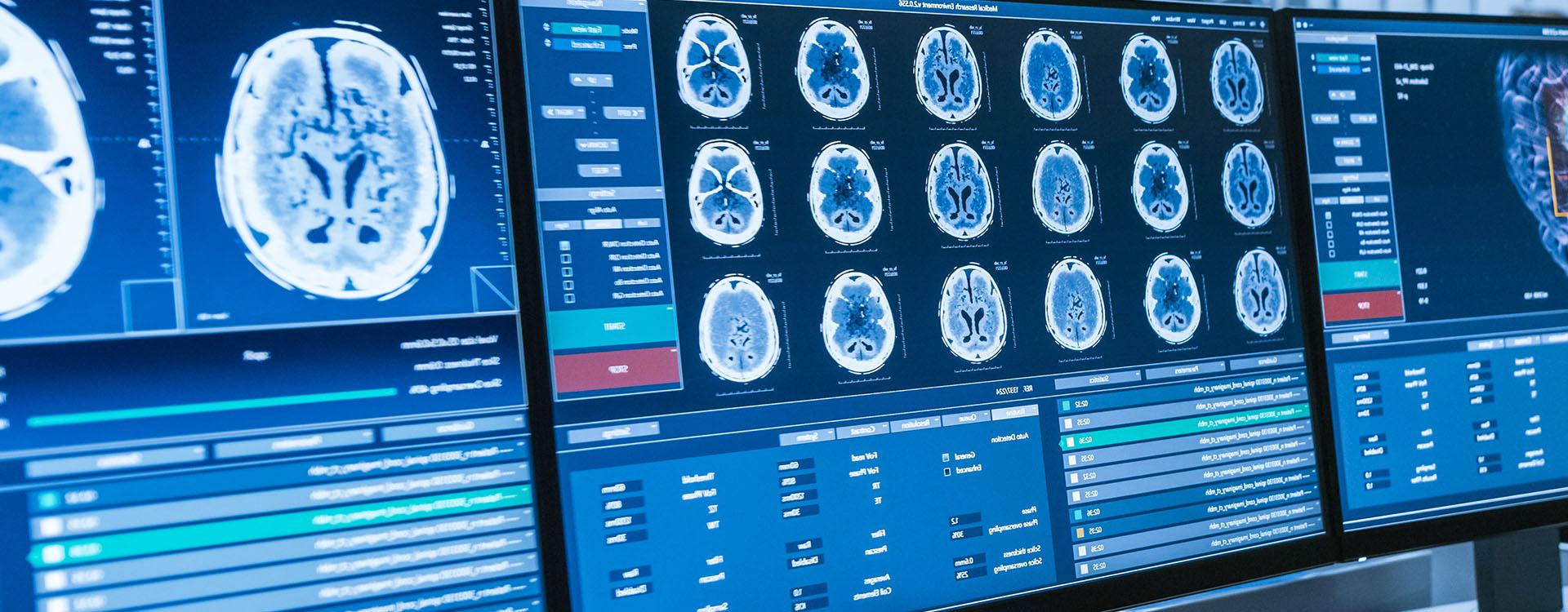 显示医学检查结果的电脑显示器